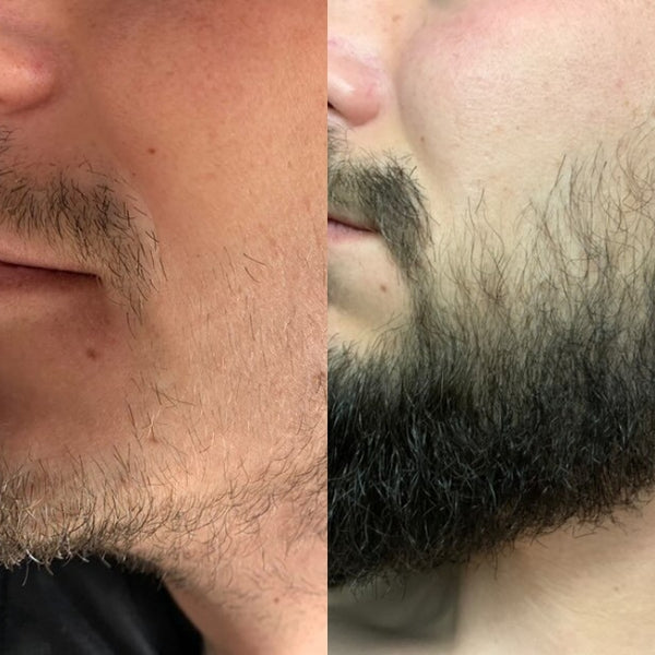 Signs Your Beard is Growing (Even If You Can’t See It Yet)