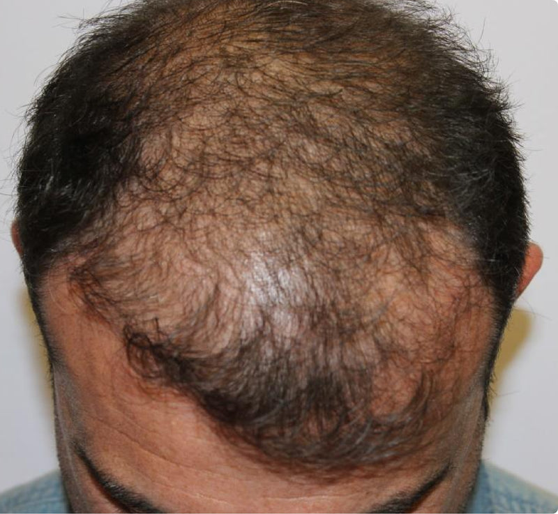 Customer 4 after