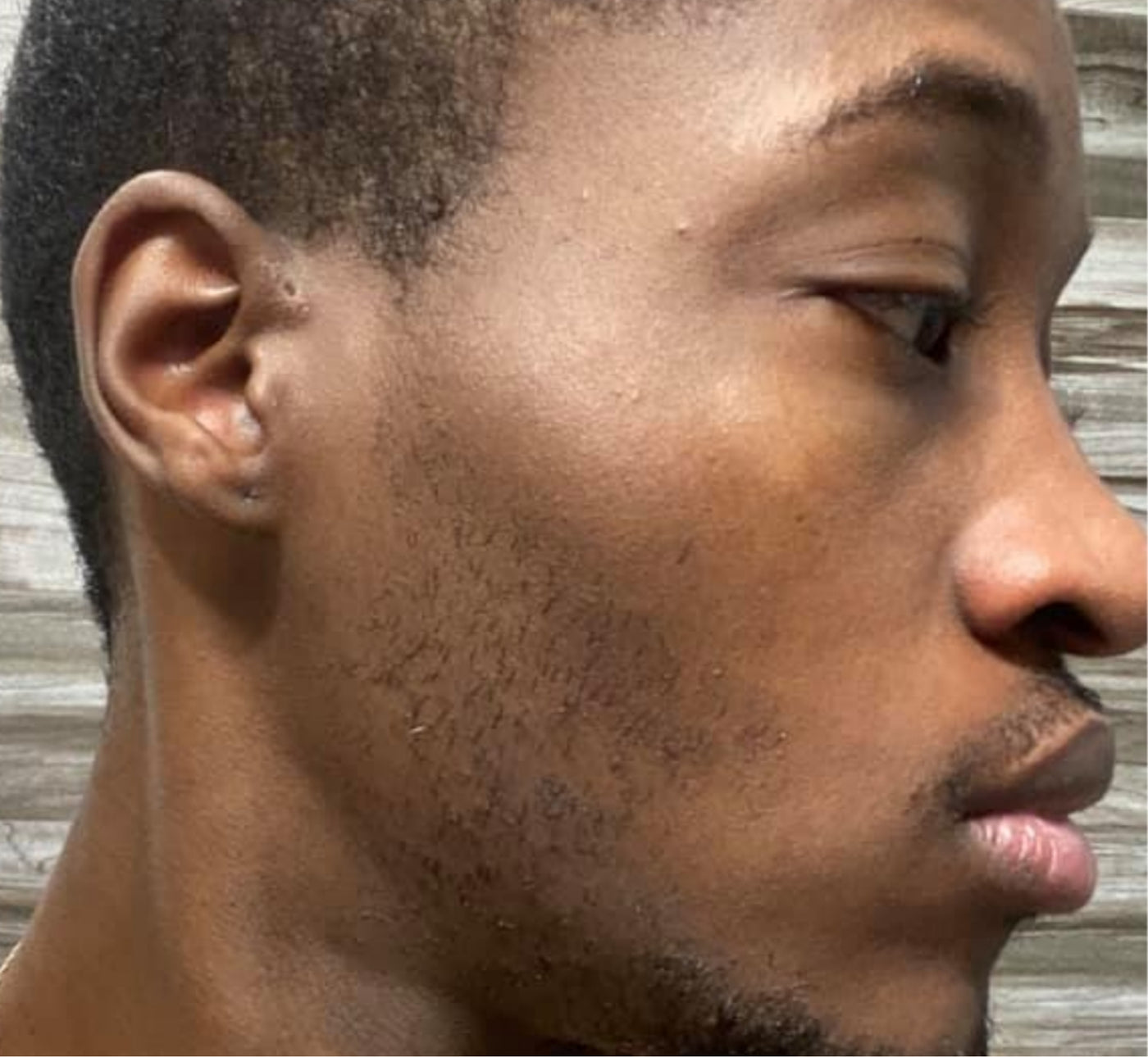 Beard Growth Science