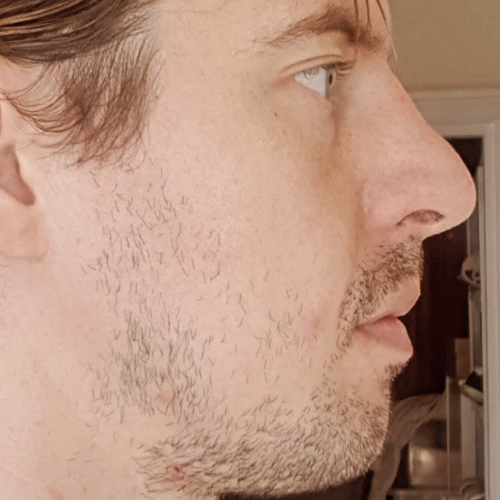 Callum, before