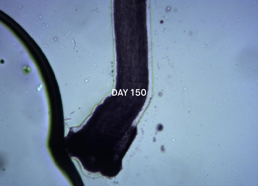 The same hair under the microscope after 150 days of the study