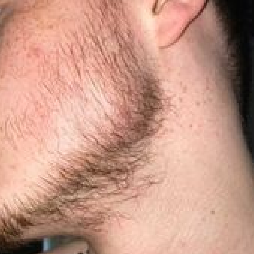 Harry, after