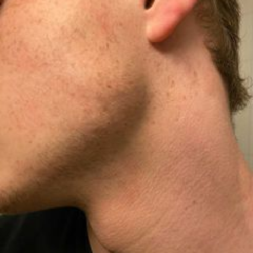 Harry, before