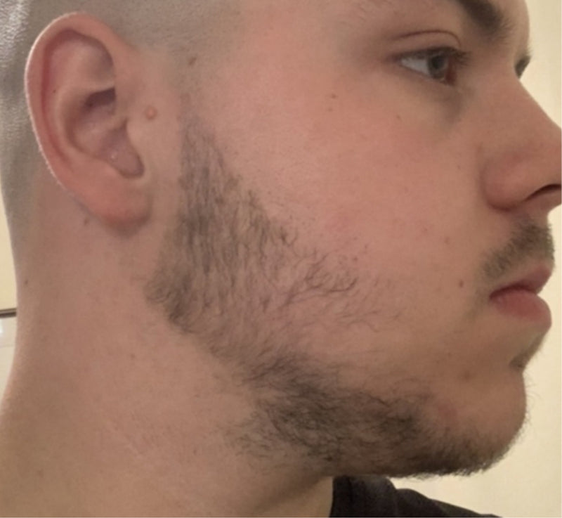 Morgan, before