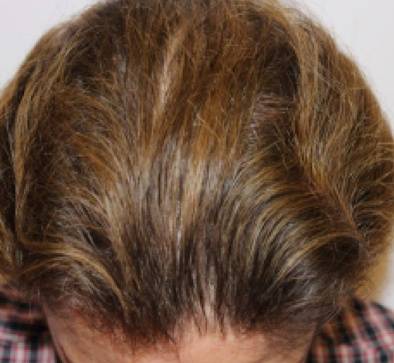 Test person 1 after