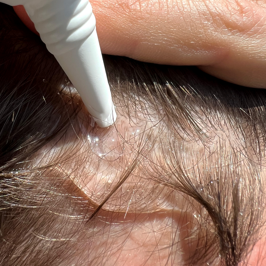 Hair Activator serum applied to the scalp